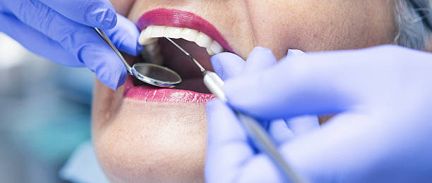 Best Emergency Dental Care for Sports Injuries in Carteret, NJ